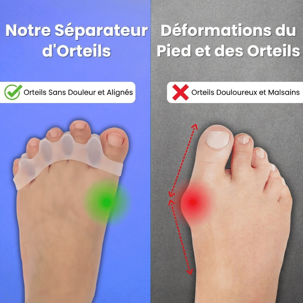 Séparateurs d'Orteils Premium en Silicone